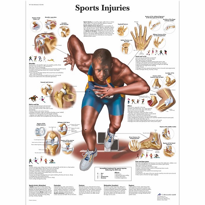 Anatomie Poster sportblessures